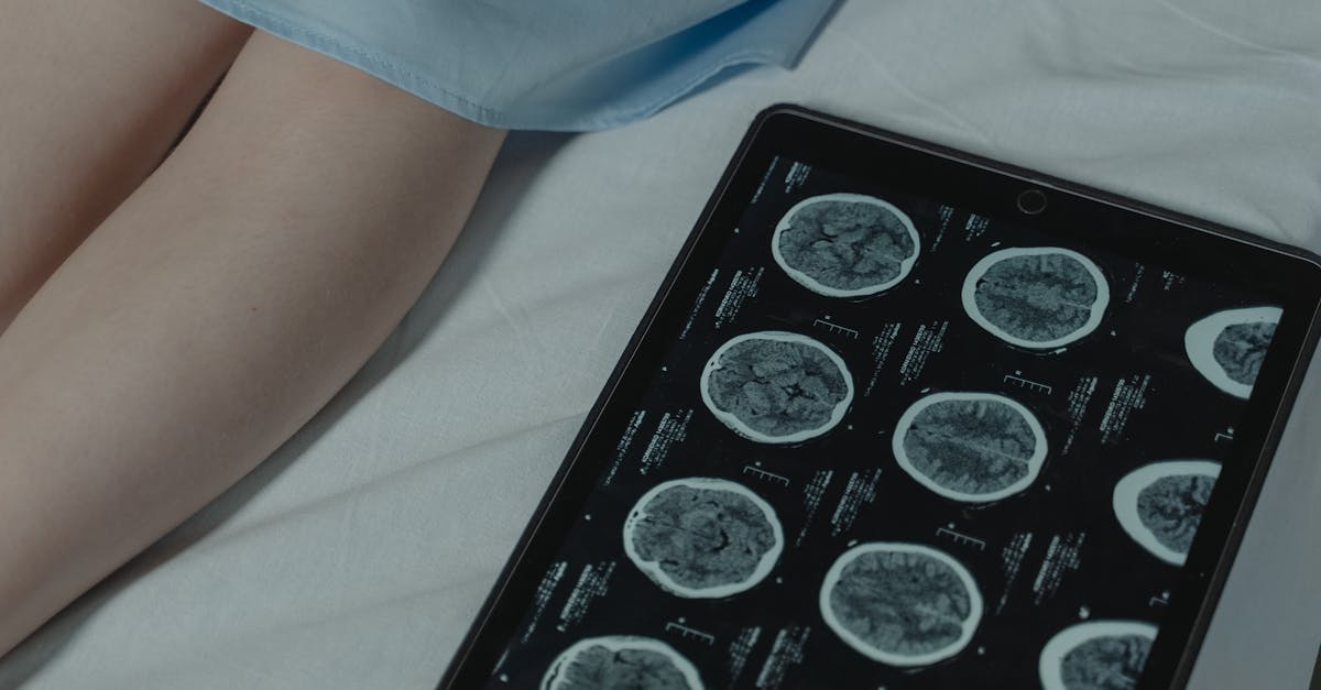 Medical Imaging
