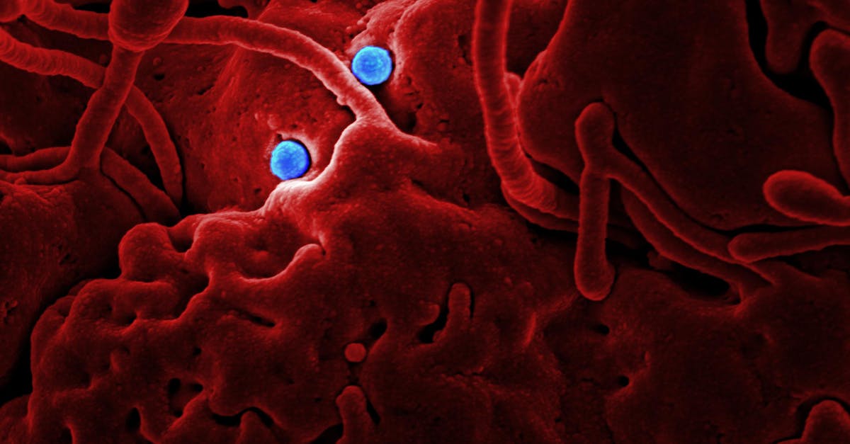 Ebola