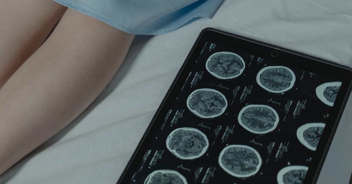 close‑up of a smartwatch on a wrist beside a dog with a brain scan overlay