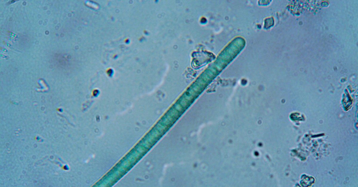 When Worms Forget and Stars Change Color